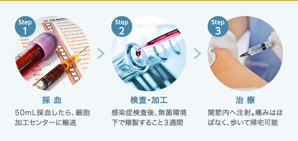 PRP-FD(PFC-FD)注射の治療の流れ