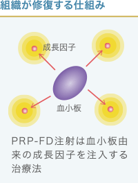 組織修復の仕組みの説明