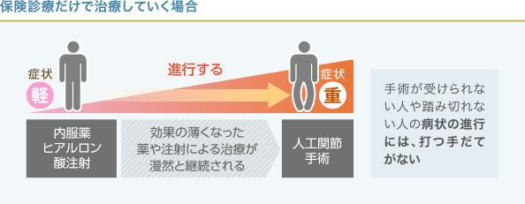 変形性ひざ関節症の進行と治療法の関係